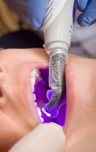 tooth coloring