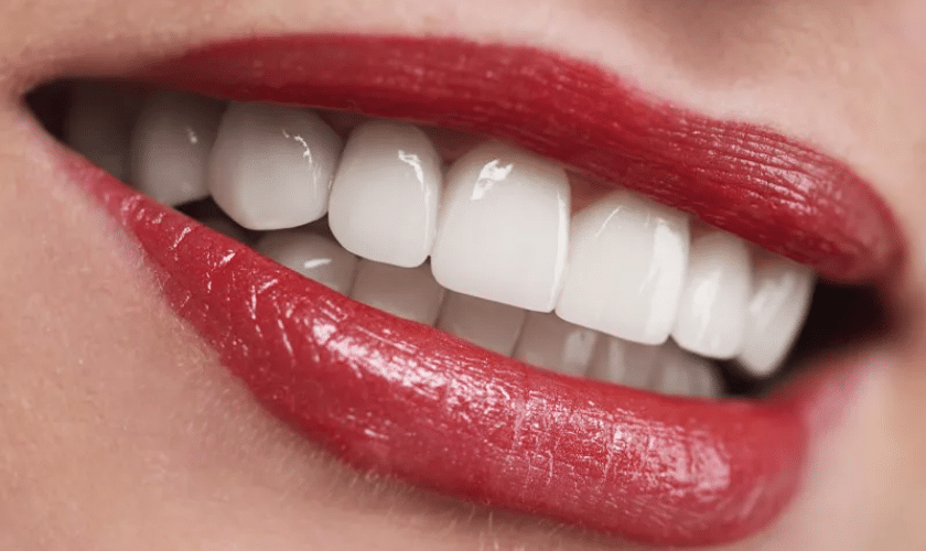 Professional Teeth Whitening in Winchester VA