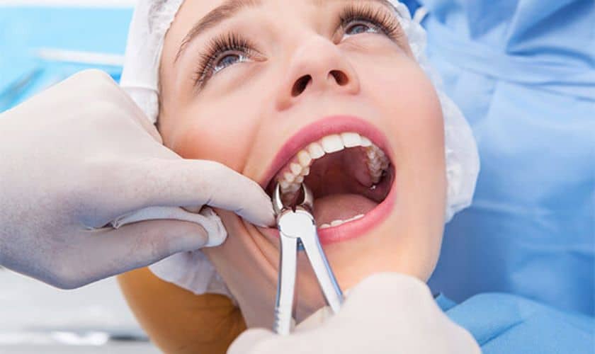 Tooth Extraction in Winchester