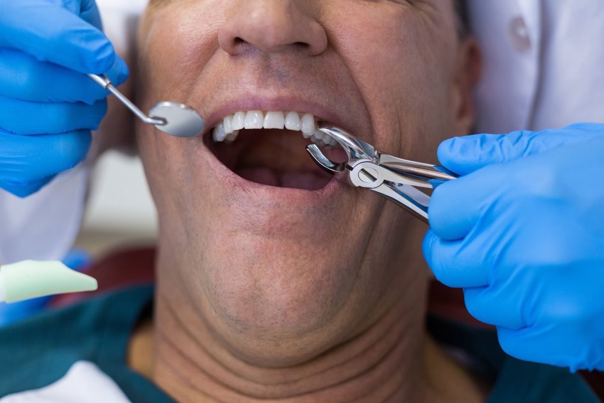 dentist perform tooth extraction to male dental patients