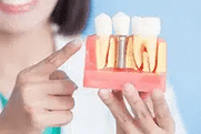 Person holding red container of french fries against blue background, pointing at it.