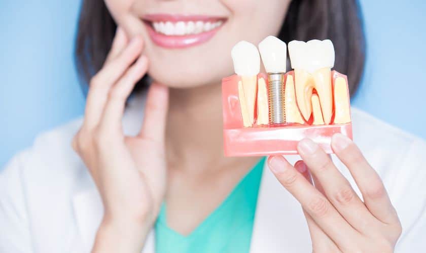 DENTAL IMPLANTS