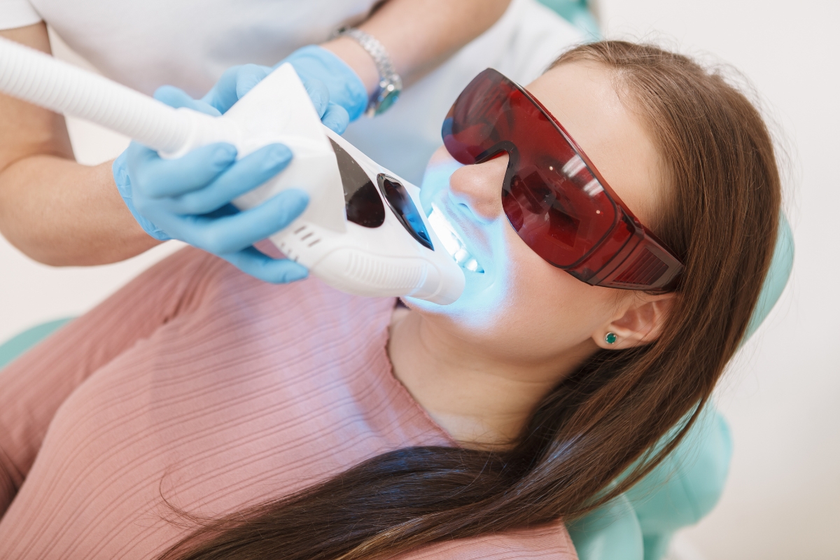 Teeth Whitening Winchester