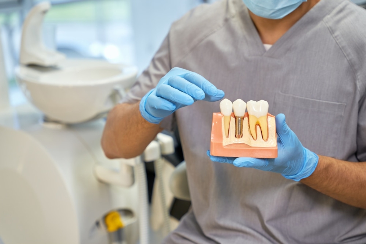Dental Implants in Winchester