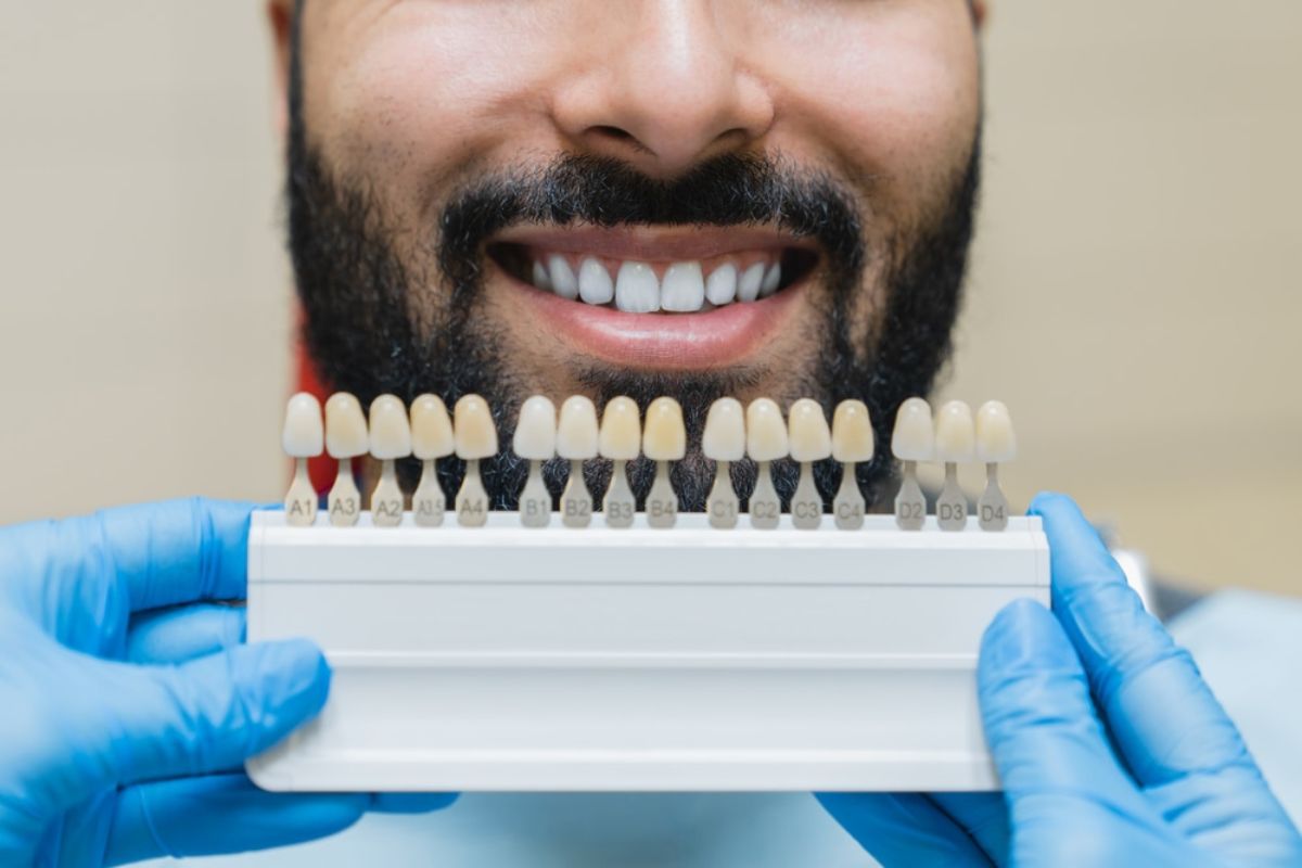 Porcelain Dental Veneers in Winchester