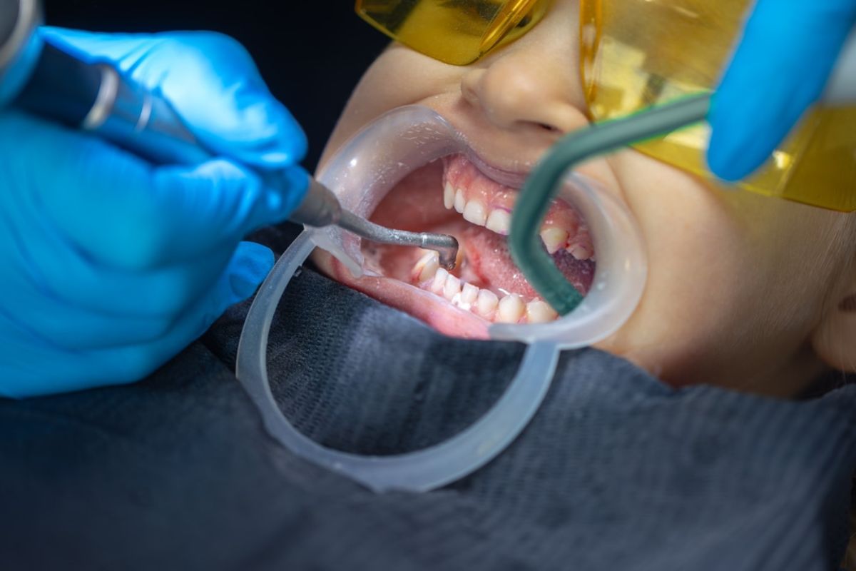 Full-Mouth Dental Restoration in Winchester