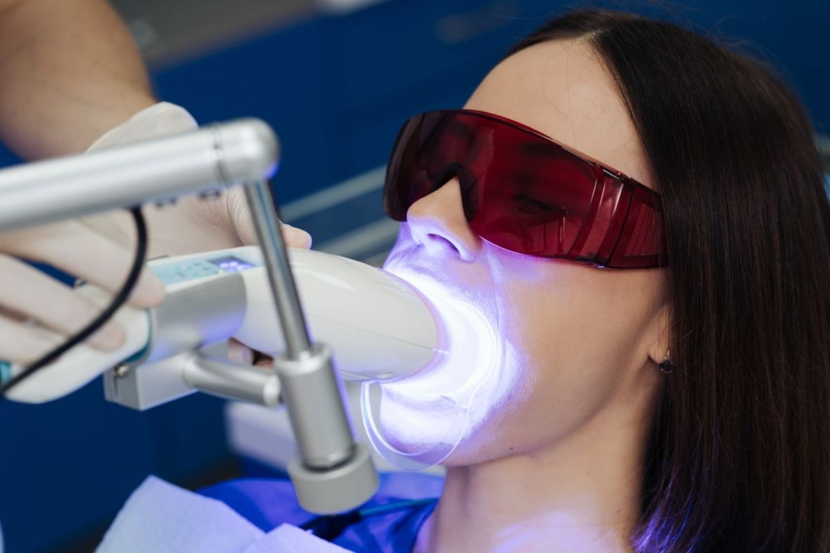 Teeth Whitening in Winchester