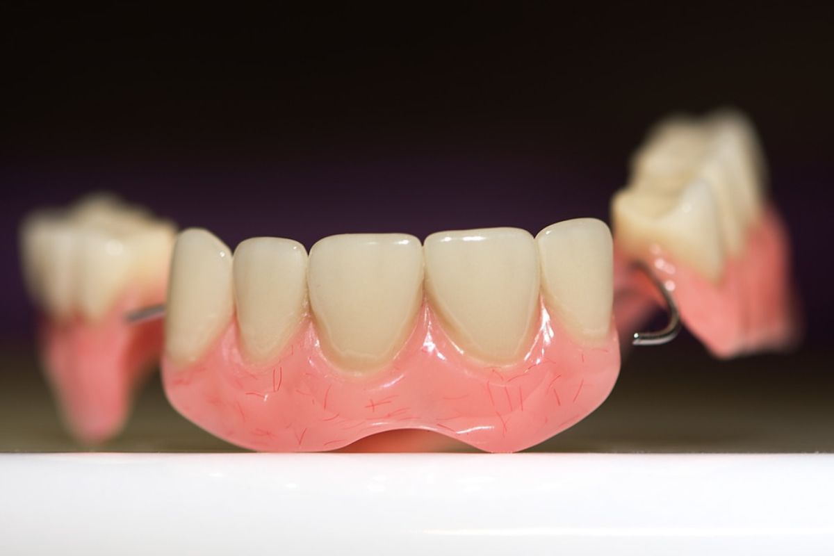 Dental Bridges In Winchester