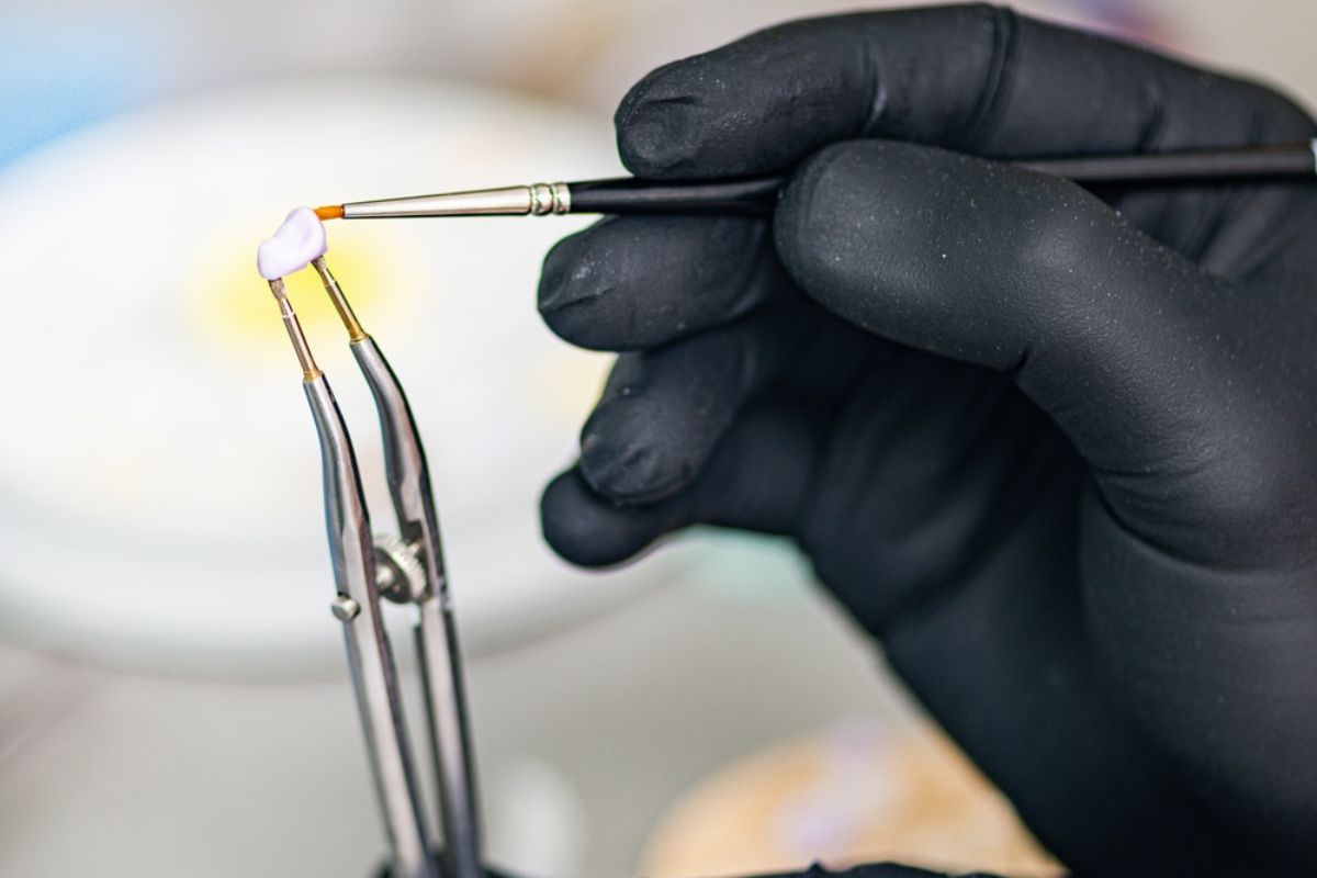 Dental crowns in Winchester