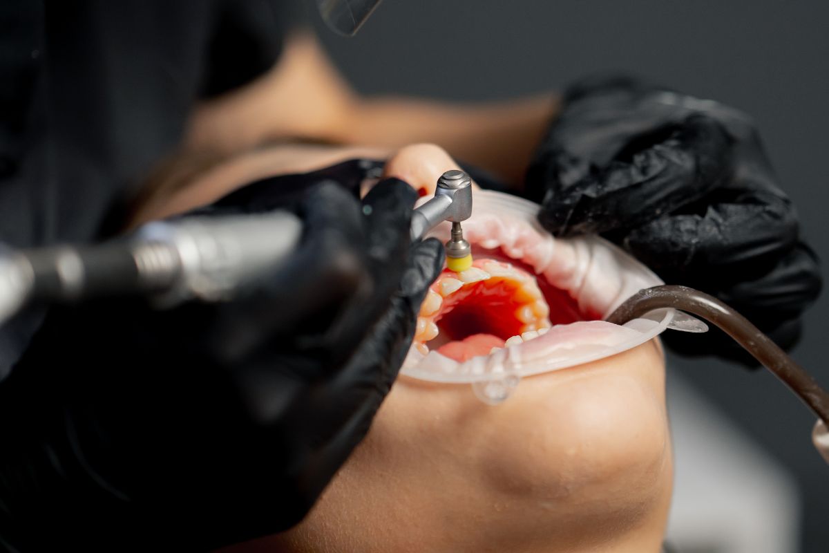 Dentist in black gloves performing dental procedure on patient's open mouth with red mouth guard.