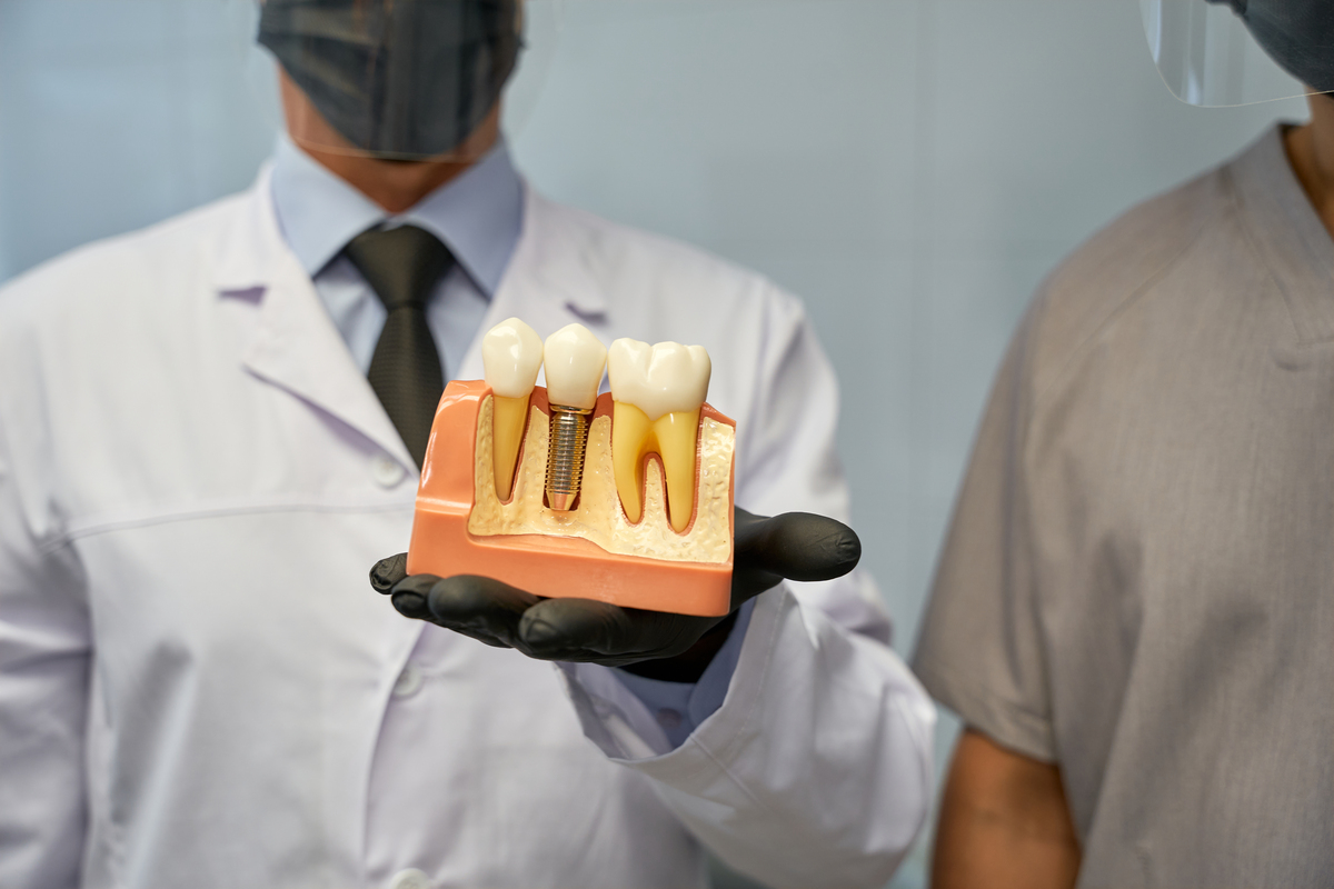 Dental Implants Winchester