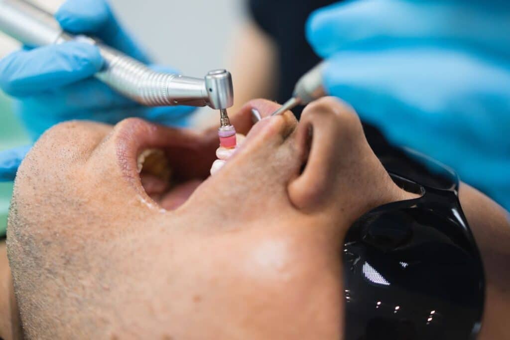 Dentist using dental handpiece to polish patient's teeth during professional cleaning.