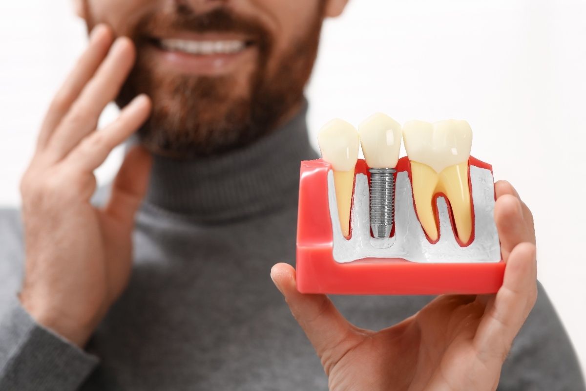 Dental Implants Winchester