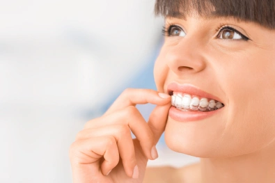 Woman showing clear Invisalign aligners and her smile