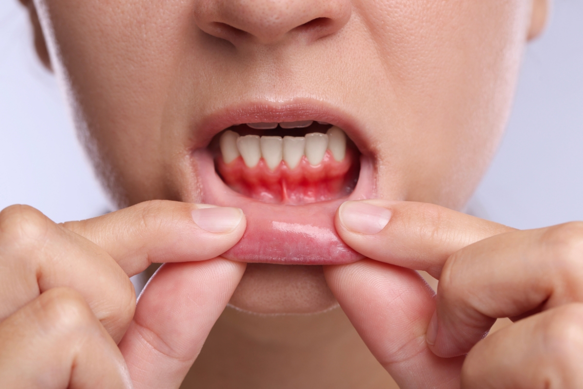 Can Periodontal Treatment Affect Your Sensitive Teeth?